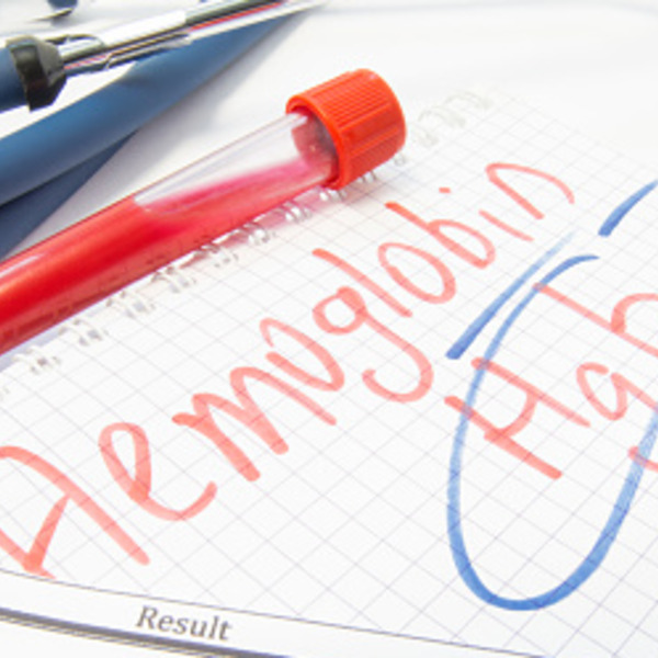 thumbnail of Hemoglobiini viitearvot